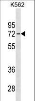 IL22RA1 / IL22R Antibody - IL22RA1 Antibody western blot of K562 cell line lysates (35 ug/lane). The IL22RA1 antibody detected the IL22RA1 protein (arrow).