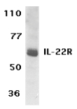 IL22RA1 / IL22R Antibody - Western blot of IL-22R expression in human HepG2 cell lysate with IL-22R antibody at 1 ug /ml.