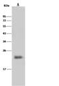 IL23 Antibody - Anti-Il23a rabbit polyclonal antibody at 1:500 dilution. Lane A: Mouse pancreas tissue lysate. Lysates/proteins at 30 ug per laneSecondaryGoat Anti-Rabbit IgG (H+L)/HRP at 1/10000 dilution. Developed using the ECL technique. Performed under reducing conditions. Predicted band size: 21 kDa. Observed band size: 23 kDa.