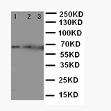 IL23A / IL-23 p19 Antibody - WB of IL23A / IL-23 p19 antibody. Lane 1: Recombinant Mouse IL-23 Protein 10ng. Lane 2: Recombinant Mouse IL-23 Protein 5ng. Lane3 : Recombinant Mouse IL-23 Protein 2.5ng..