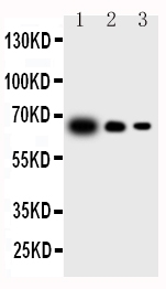 IL23A / IL-23 p19 Antibody - All lanes: Anti-IL23 P19 antibody, Lane 1: Recombinant Mouse IL-23 Protein 10ng Lane 2: Recombinant Mouse IL-23 Protein 5ng Lane 3: Recombinant Mouse IL-23 Protein 2. 5ng