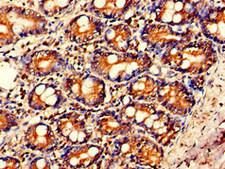 IL23A / IL-23 p19 Antibody - Immunohistochemistry of paraffin-embedded human small intestine tissue at dilution of 1:100