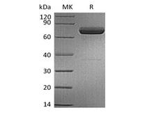 IL23A / IL-23 p19 Protein - Recombinant Human IL-23 alpha & Mouse IL-12 beta Heterodimer (C-6His)