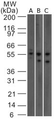 IL23R Antibody - Western Blot: IL23 Receptor Antibody (15N6C6) - Analysis using IL-23 receptor antibody. Lysate from (A) human HCT116, (B) Jurkat and C) mouse NIH 3T3 cells probed with IL-23 receptor antibody at 1 ug/ml.