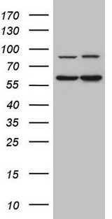 IL23R Antibody - HEK293T cells were transfected with the pCMV6-ENTRY control. (Left lane) or pCMV6-ENTRY IL23R. (Right lane) cDNA for 48 hrs and lysed. Equivalent amounts of cell lysates. (5 ug per lane) were separated by SDS-PAGE and immunoblotted with anti-IL23R.