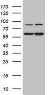 IL23R Antibody - HEK293T cells were transfected with the pCMV6-ENTRY control (Left lane) or pCMV6-ENTRY IL23R (Right lane) cDNA for 48 hrs and lysed. Equivalent amounts of cell lysates (5 ug per lane) were separated by SDS-PAGE and immunoblotted with anti-IL23R.