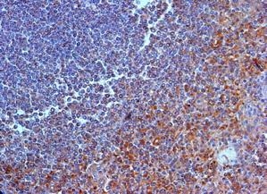 IL23R Antibody - Immunohistochemistry of paraffin-embeddedi human spleen stained with Goat anti-human IL-23 Receptor