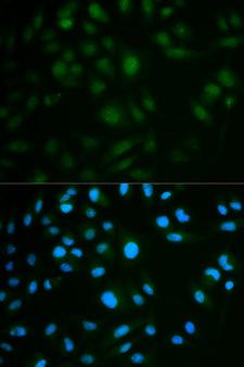 IL23R Antibody - Immunofluorescence analysis of MCF7 cell using IL23R antibody. Blue: DAPI for nuclear staining.