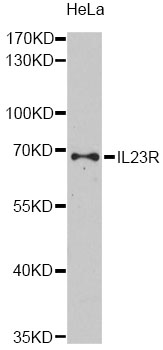 IL23R Antibody - Western blot analysis of extracts of HeLa cells, using IL23R antibody at 1:1000 dilution. The secondary antibody used was an HRP Goat Anti-Rabbit IgG (H+L) at 1:10000 dilution. Lysates were loaded 25ug per lane and 3% nonfat dry milk in TBST was used for blocking. An ECL Kit was used for detection and the exposure time was 90s.