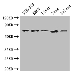 IL23R Antibody - Positive WB detected in:NIH/3T3 whole cell lysate,K562 whole cell lysate,Mouse liver tissue,Mouse lung tissue,Mouse spleen tissue;All lanes: IL23R antibody at 3.4ug/ml;Secondary;Goat polyclonal to rabbit IgG at 1/50000 dilution;Predicted band size: 72,43,41,21,31,26 kDa;Observed band size: 72 kDa;