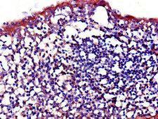 IL23R Antibody - Immunohistochemistry of paraffin-embedded human tonsil tissue using IL23R Antibody at dilution of 1:100