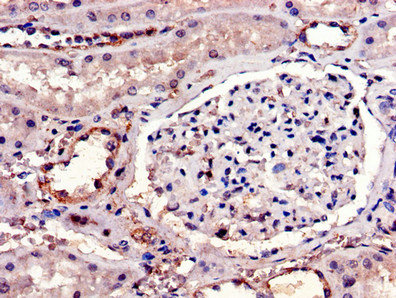 IL23R Antibody - Immunohistochemistry of paraffin-embedded human kidney tissue using IL23R Antibody at dilution of 1:100