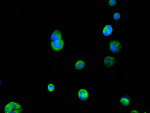 IL23R Antibody - Immunofluorescent analysis of MCF-7 cells using IL23R Antibody at a dilution of 1:100 and Alexa Fluor 488-congugated AffiniPure Goat Anti-Rabbit IgG(H+L)