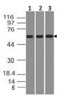 IL23R Antibody - Fig-1: Western blot analysis of IL-23R. Anti-IL-23R antibody was used at 1 µg/ml on (1) MCF-7, (2) THP1 and (3) A431 lysates.