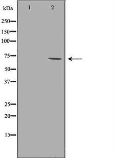 IL23R Antibody - Western blot analysis of K562 whole cells lysates using IL23R antibody. The lane on the left is treated with the antigen-specific peptide.