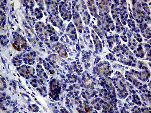 IL24 Antibody - Immunohistochemical staining of paraffin-embedded Human pancreas tissue within the normal limits using anti-IL24 mouse monoclonal antibody. (Heat-induced epitope retrieval by 1mM EDTA in 10mM Tris buffer. (pH8.5) at 120°C for 3 min. (1:2000)