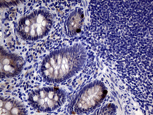 IL24 Antibody - Immunohistochemical staining of paraffin-embedded Human colon tissue within the normal limits using anti-IL24 mouse monoclonal antibody. (Heat-induced epitope retrieval by 1mM EDTA in 10mM Tris buffer. (pH8.5) at 120°C for 3 min. (1:2000)