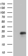 IL24 Antibody - HEK293T cells were transfected with the pCMV6-ENTRY control. (Left lane) or pCMV6-ENTRY IL24. (Right lane) cDNA for 48 hrs and lysed. Equivalent amounts of cell lysates. (5 ug per lane) were separated by SDS-PAGE and immunoblotted with anti-IL24. (1:2000)