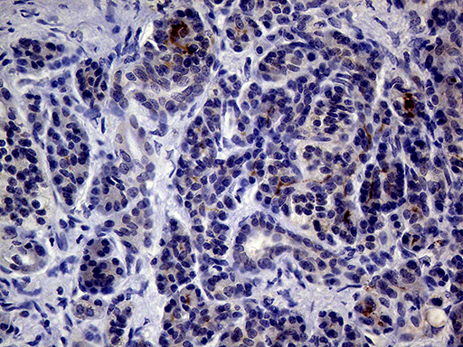 IL24 Antibody - Immunohistochemical staining of paraffin-embedded Human pancreas tissue within the normal limits using anti-IL24 mouse monoclonal antibody. (Heat-induced epitope retrieval by 1mM EDTA in 10mM Tris buffer. (pH8.5) at 120°C for 3 min. (1:2000)