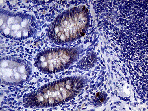 IL24 Antibody - Immunohistochemical staining of paraffin-embedded Human colon tissue within the normal limits using anti-IL24 mouse monoclonal antibody. (Heat-induced epitope retrieval by 1mM EDTA in 10mM Tris buffer. (pH8.5) at 120°C for 3 min. (1:2000)