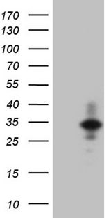 IL24 Antibody - HEK293T cells were transfected with the pCMV6-ENTRY control. (Left lane) or pCMV6-ENTRY IL24. (Right lane) cDNA for 48 hrs and lysed. Equivalent amounts of cell lysates. (5 ug per lane) were separated by SDS-PAGE and immunoblotted with anti-IL24. (1:2000)