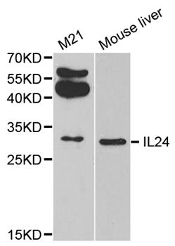IL24 Antibody - Western blot analysis of extracts of M21 cell and mouse liver.