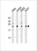 IL24 Antibody - All lanes : Anti-IL24 Antibody at 1:2000 dilution Lane 1: HeLa whole cell lysates Lane 2: Jurkat whole cell lysates Lane 3: K562 whole cell lysates Lane 4: A431 whole cell lysates Lysates/proteins at 20 ug per lane. Secondary Goat Anti-Rabbit IgG, (H+L), Peroxidase conjugated at 1/10000 dilution Predicted band size : 24 kDa Blocking/Dilution buffer: 5% NFDM/TBST.