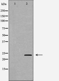 IL24 Antibody - Western blot analysis of A431 cell lysates using IL24 antibody. The lane on the left is treated with the antigen-specific peptide.