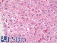 IL25 / IL17E Antibody - Human Liver: Formalin-Fixed, Paraffin-Embedded (FFPE)