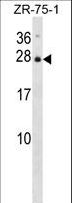 IL25 / IL17E Antibody - IL25 Antibody western blot of ZR-75-1 cell line lysates (35 ug/lane). The IL25 antibody detected the IL25 protein (arrow).