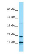 IL26 Antibody - IL26 / IL-26 antibody Western Blot of ACHN.  This image was taken for the unconjugated form of this product. Other forms have not been tested.