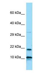 IL26 Antibody - IL26 / IL-26 antibody Western Blot of ACHN.  This image was taken for the unconjugated form of this product. Other forms have not been tested.