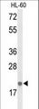 IL26 Antibody - Western blot of IL26 Antibody in HL-60 cell line lysates (35 ug/lane). IL26 (arrow) was detected using the purified antibody.