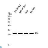 IL26 Antibody - Western Blot (WB) analysis of Rat Muscle Rat SPLEEN 293T SH-SY5Y using IL26 antibody.