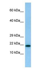 IL26 Antibody - IL26 / IL-26 antibody Western Blot of HeLa.  This image was taken for the unconjugated form of this product. Other forms have not been tested.