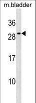 IL27 Antibody - Mouse Il27 Antibody western blot of mouse bladder tissue lysates (35 ug/lane). The Il27 antibody detected the Il27 protein (arrow).