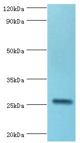 IL27 Antibody - Western blot. All lanes: IL27 antibody at 2 ug/ml+mouse liver tissue. Secondary antibody: Goat polyclonal to rabbit at 1:10000 dilution. Predicted band size: 27 kDa. Observed band size: 27 kDa.