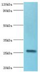 IL27 Antibody - Western blot. All lanes: IL27 antibody at 2 ug/ml+mouse liver tissue. Secondary antibody: Goat polyclonal to rabbit at 1:10000 dilution. Predicted band size: 27 kDa. Observed band size: 27 kDa.