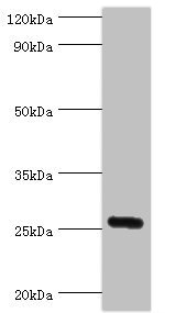 IL27 Antibody - Western blot All lanes: IL27 antibody at 2µg/ml + Mouse liver tissue Secondary Goat polyclonal to rabbit IgG at 1/10000 dilution Predicted band size: 27 kDa Observed band size: 27 kDa