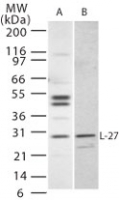 IL27 Antibody - Western blot of IL-27 in (A) Jurkat and (B) NIH 3T3 cells using antibody at 1 ug/ml.