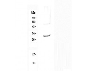 IL27 Antibody - Western blot analysis of IL27 using anti-IL27 antibody
