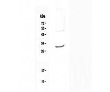 IL27 Antibody - Western blot analysis of IL27 using anti-IL27 antibody