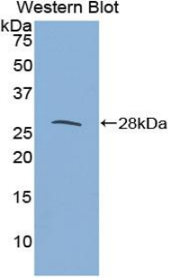 IL27RA Antibody - Western blot of recombinant IL27RA / WSX-1.  This image was taken for the unconjugated form of this product. Other forms have not been tested.
