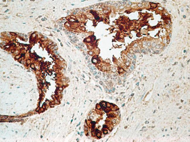 IL27RA Antibody - Immunohistochemistry-Paraffin: IL27RA Antibody (34N4G11) - Formalin-fixed, paraffin-embedded human prostate probed with IL-27R antibody at 5 ug/ml.  This image was taken for the unconjugated form of this product. Other forms have not been tested.