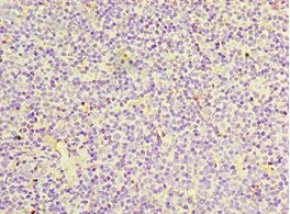 IL27RA Antibody - Immunohistochemistry of paraffin-embedded human tonsil tissue using antibody at 1:100 dilution.