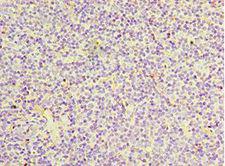 IL27RA Antibody - Immunohistochemistry of paraffin-embedded human tonsil tissue using antibody at 1:100 dilution.