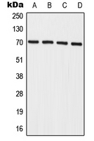 IL27RA Antibody - Western blot analysis of IL-27RA expression in A549 (A); HeLa (B); mouse spleen (C); rat spleen (D) whole cell lysates.