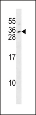 IL28B Antibody - IL28B Antibody western blot of SK-BR-3 cell line lysates (35 ug/lane). The IL28B antibody detected the IL28B protein (arrow).