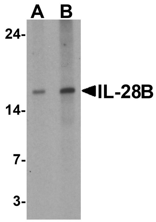 IL28B Antibody - Western blot analysis of IL-28B in HeLa cell lysate with IL-28B antibody at (A) 1 and (B) 2 ug/ml.