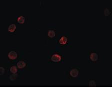 IL28B Antibody - Immunofluorescence of IL-28B in HeLa cells with IL-28B antibody at 5 ug/ml.